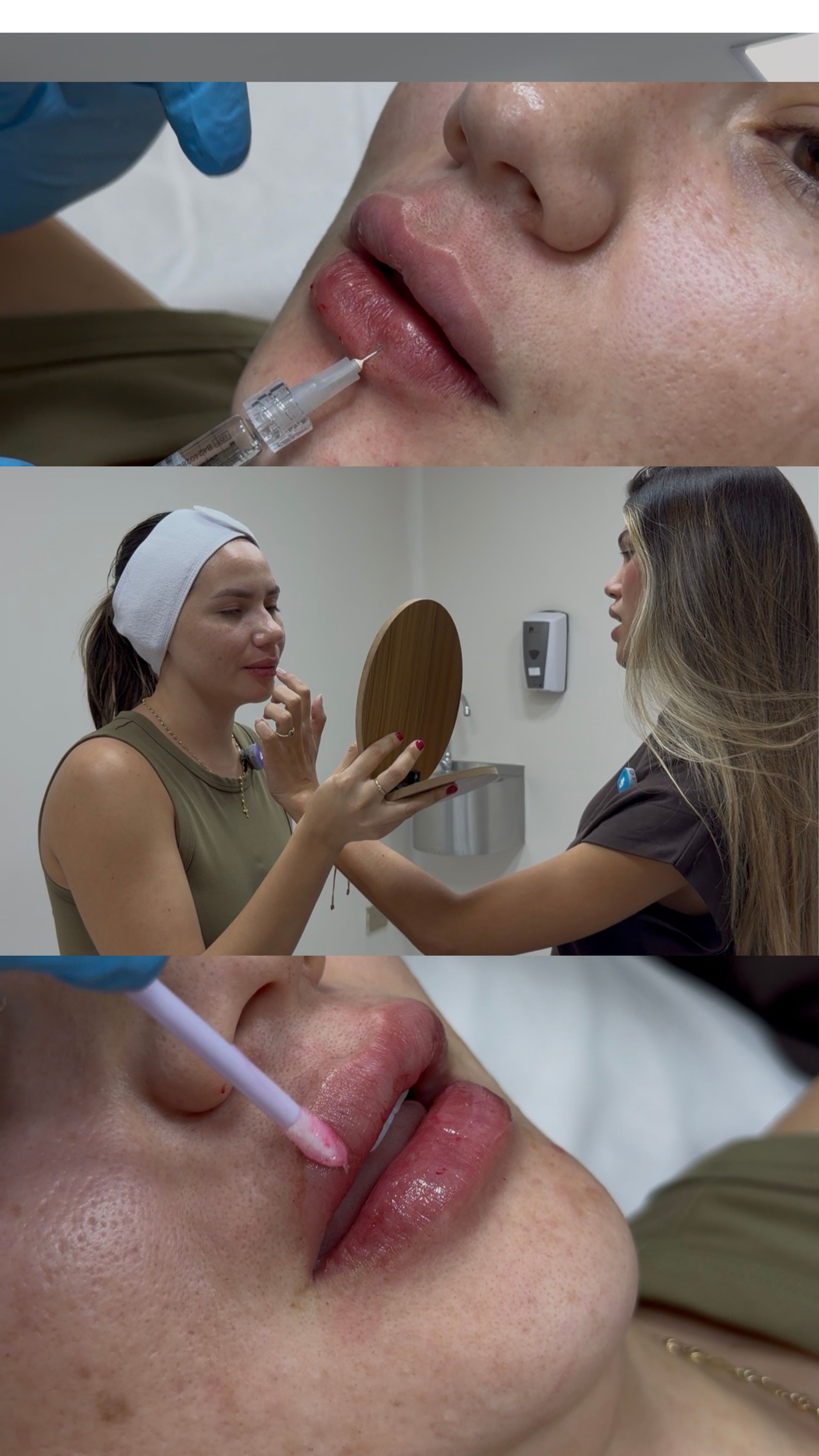 Técnica SS Heart Lips™ — procedimiento en cabina con la Dra. Sharon Santiago