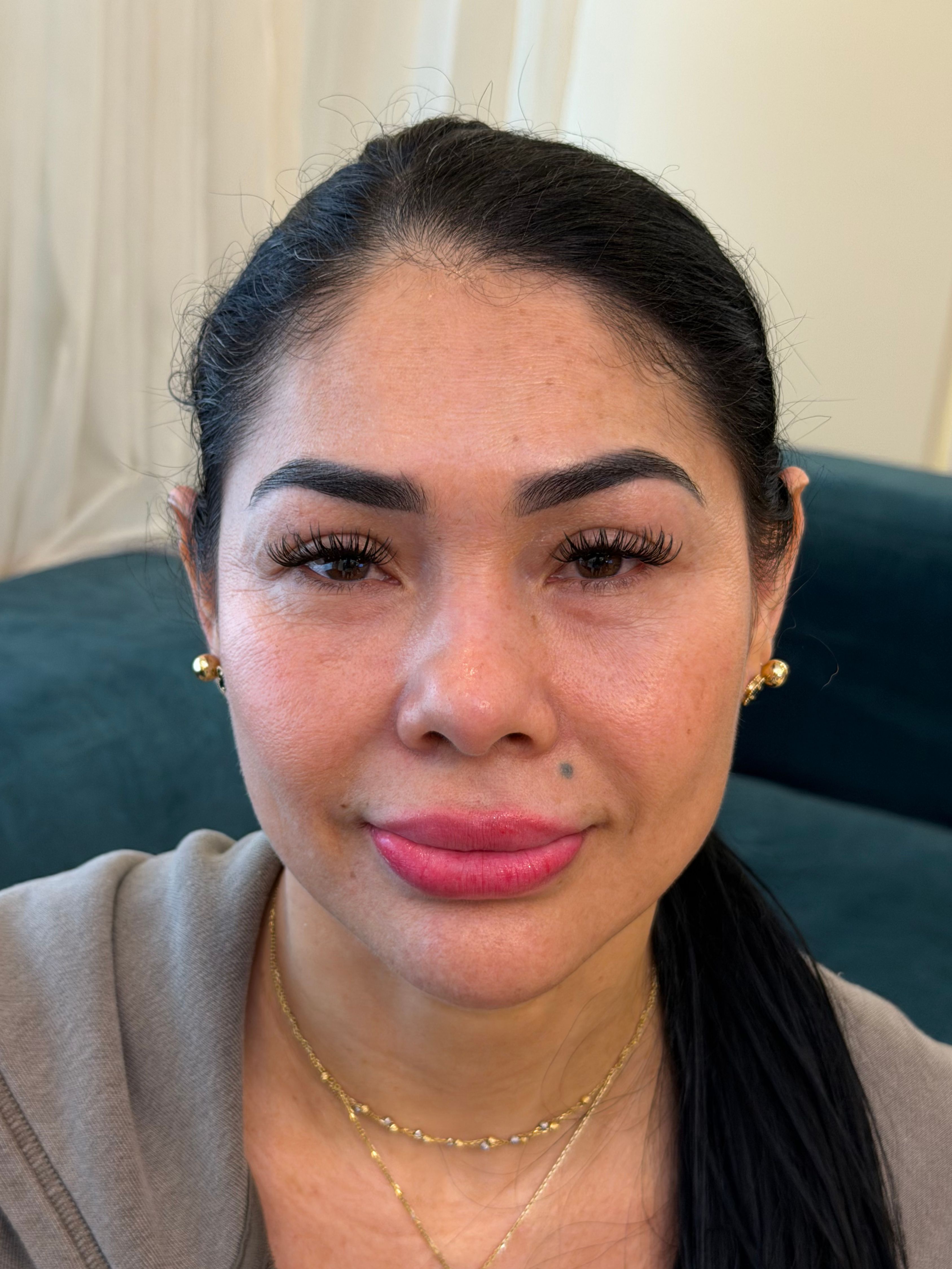 Rosa — antes del rejuvenecimiento facial
